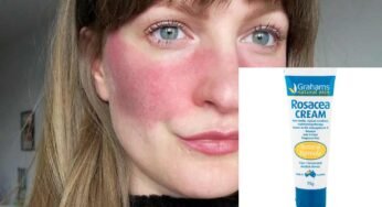 Rosacea Cream – Stops Blushing of Skin